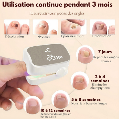 APPAREIL LED ASSYN Ongles Pieds & Mains ANTI-MYCOSES